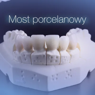 Most porcelanowy