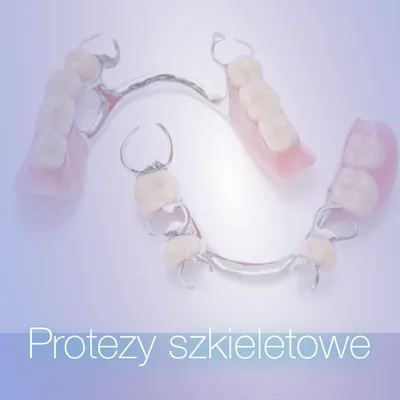 Protezy szkieletowe