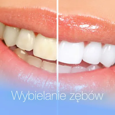 Wybielanie zębów